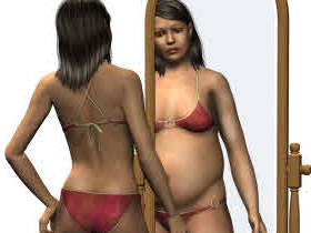 anorexia2