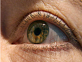 Los omega 3 pueden paliar la Degeneración Macular