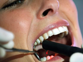 implante-dental