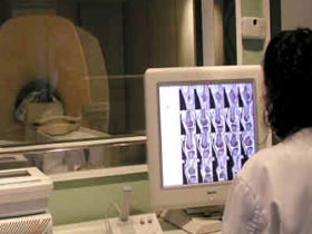 cancerdeprostata