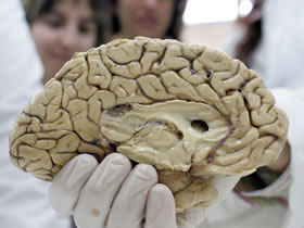 reflejo-cerebro