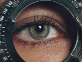 revision-ojo