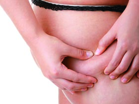 lipoescultura
