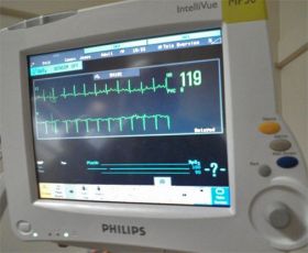 MONITOR_CARDIACO_RETOCADO