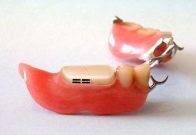 DIENTES_RETOCADO