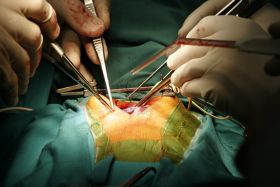 OPERACION_RETOCADO