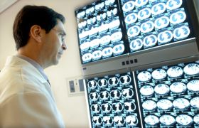 RADIOGRAFIAS_CANCER_RET