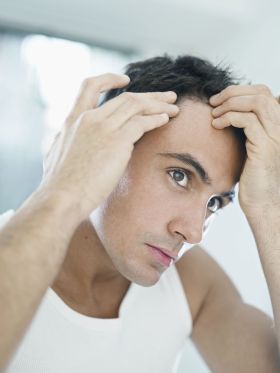La alopecia es un tema de preocupación para muchas personas.IDEAL. ALOPECIA RET