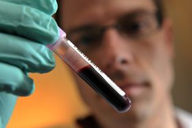ANALISIS DE SANGRE RET