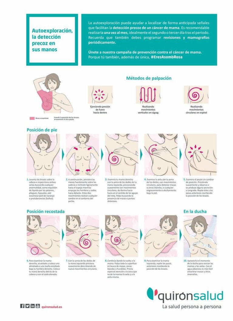 Estos son los pasos para detectar el cáncer de mama con tus propias manos