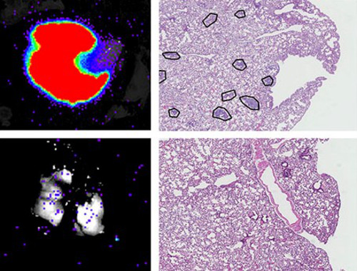 Descubierta una proteína clave en la metástasis tumoral