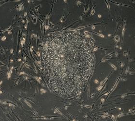 Reconstruyen los músculos del corazón con células madre