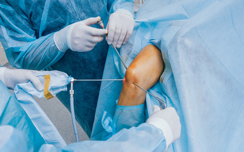 Tratamiento con artroscopia de lesiones de la rodilla en Granada