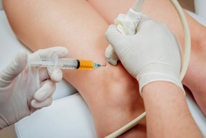 Terapias biológicas para tratar la artrosis y el dolor osteoarticular