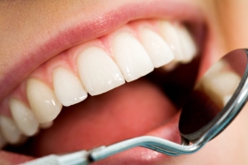 Enfermedad periodontal: ¿por qué debe preocuparnos esta gran desconocida?