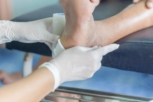 Unidad avanzada para el tratamiento de úlceras, pie diabético y heridas complejas