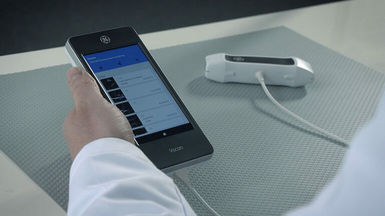 Un nuevo sistema de ultrasonido portátil permite a los especialistas obtener diagnósticos en cualquier momento y lugar