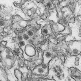 La vacuna contra el zika podría estar lista en tres años