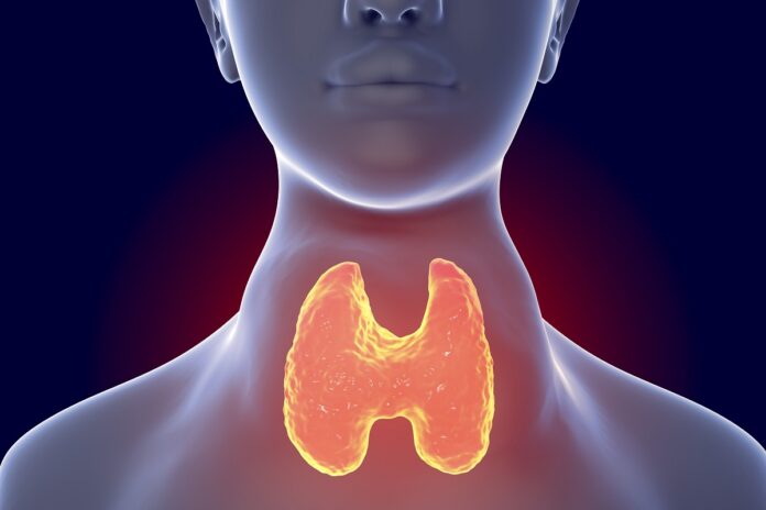 Toxic diffuse goiter, hyperthyroidism