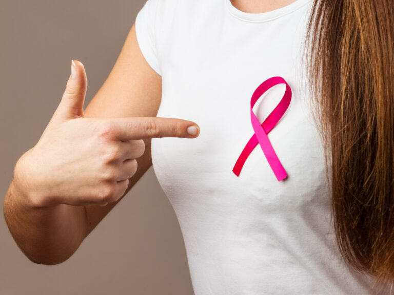 El gen BRCA no influye en la probabilidad de supervivencia al cáncer de mama