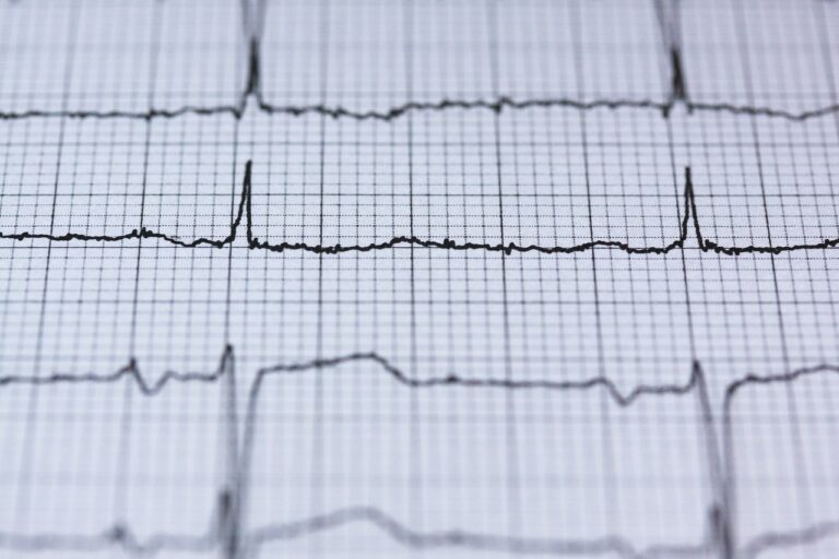 ¿Por qué se altera la frecuencia cardiaca?