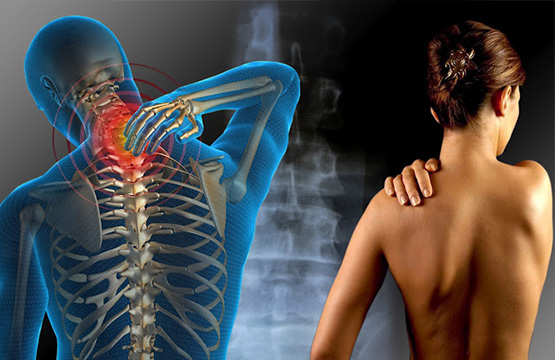 Fibromialgia: síntomas, diagnóstico y tratamiento