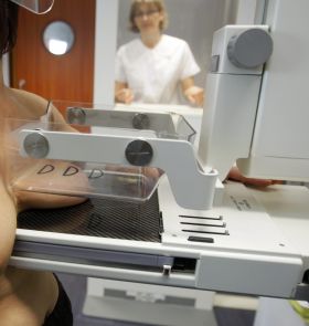 El cáncer matará 5,5 millones de mujeres al año para 2030, según un informe