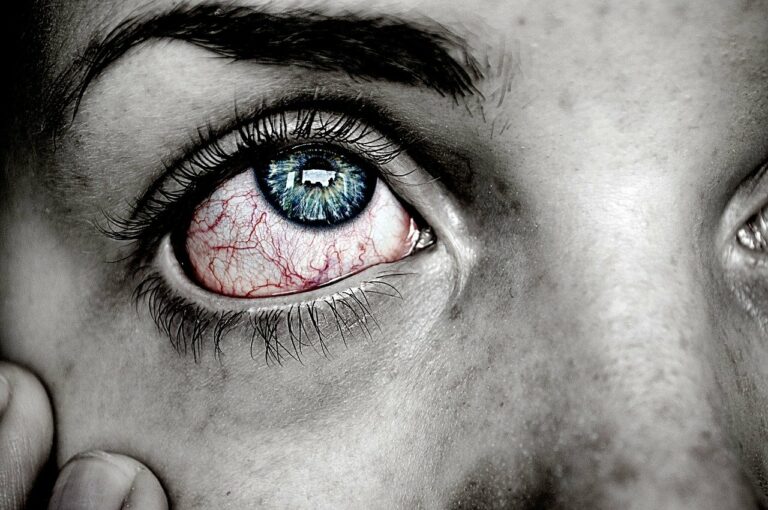 Conjuntivitis: tipos, síntomas, tratamiento y prevención