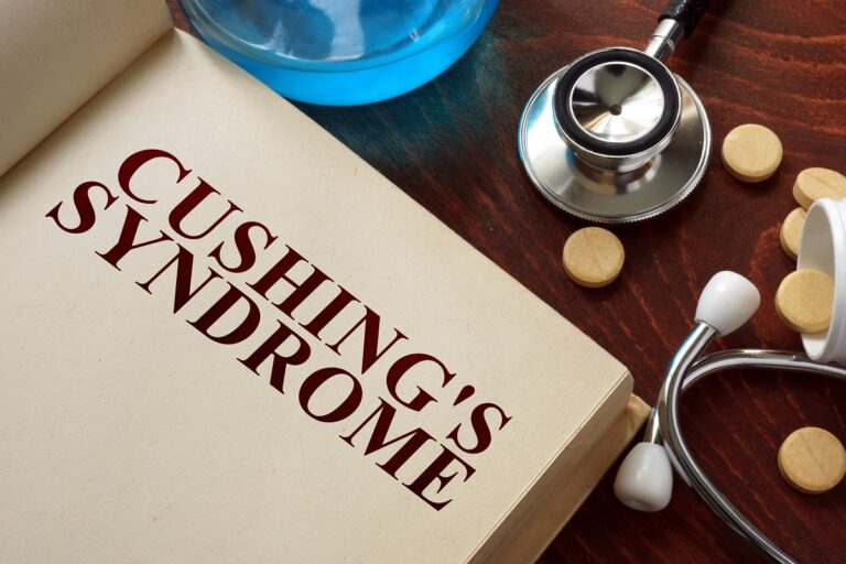 Síndrome de Cushing: causas, síntomas y tratamientos