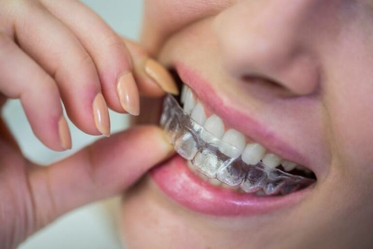 Ortodoncia invisible DR SMILE: La mejor opcion para una sonrisa radiante