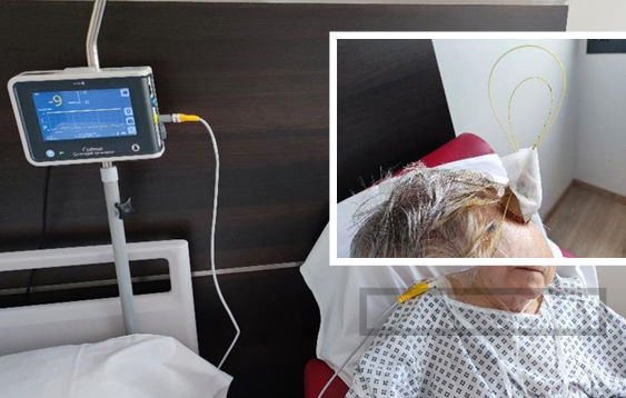 La hidrocefalia crónica del adulto: una demencia curable