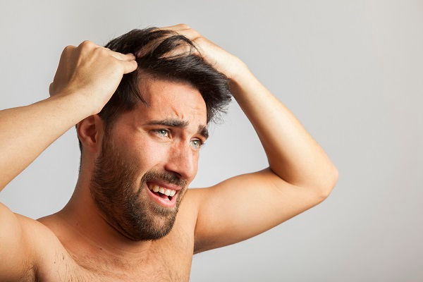 Injerto de cabello en México, ¿qué es y cuál es su precio?