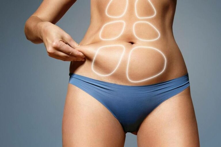 ¿Cómo eliminar la grasa localizada? El tratamiento Coolsculpting llega como novedosa solución