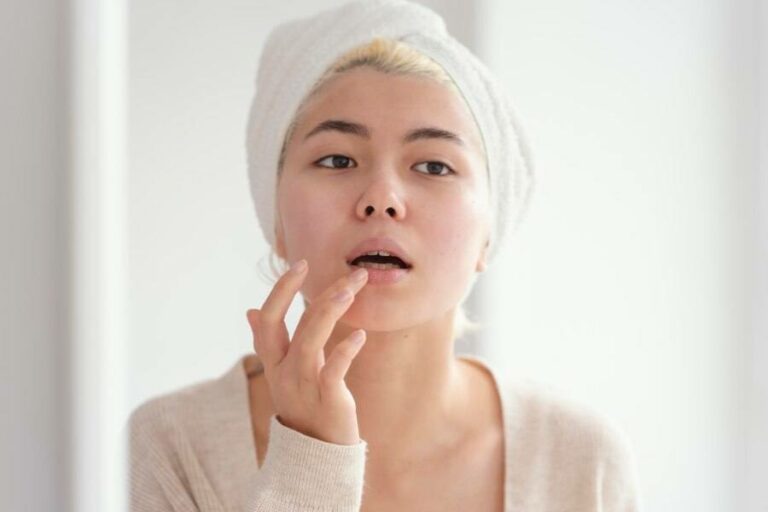 Todo lo que necesitas saber sobre el herpes labial