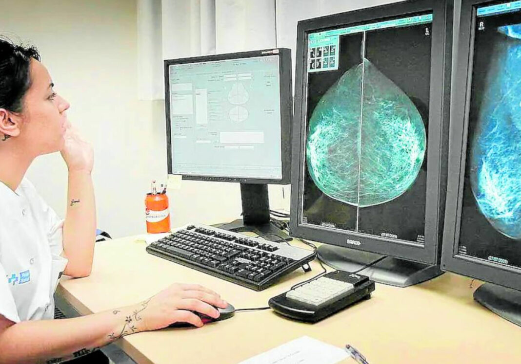 Revisión de unas pruebas de mamografía.