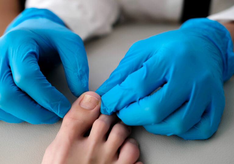 5 señales de que sufres hongos en las uñas de los pies